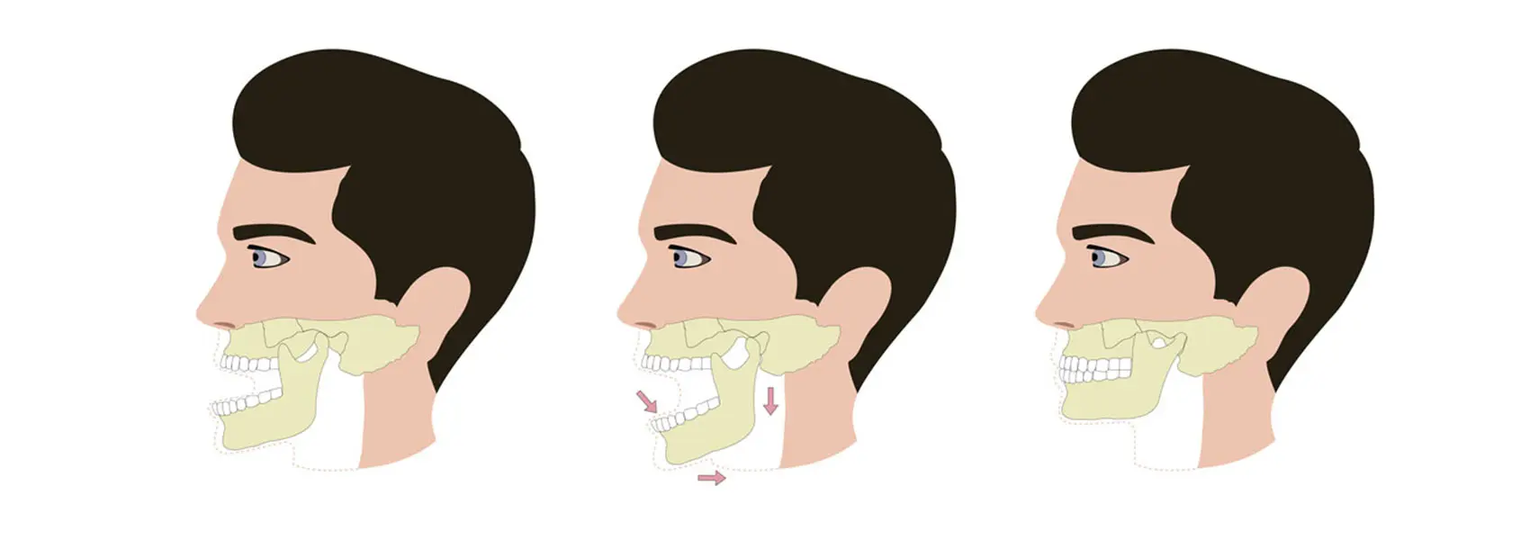 Ağız, Diş ve Çene Cerrahisi